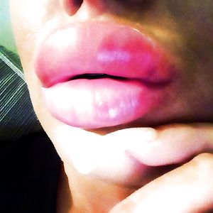 Freakishly large and fake lips - blonde