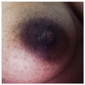 Up, close and personal - nipples