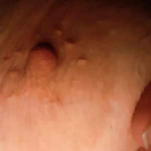 My big tits - nipples